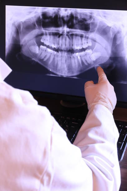 Best Emergency Dental Services for Seniors in Burns, TN